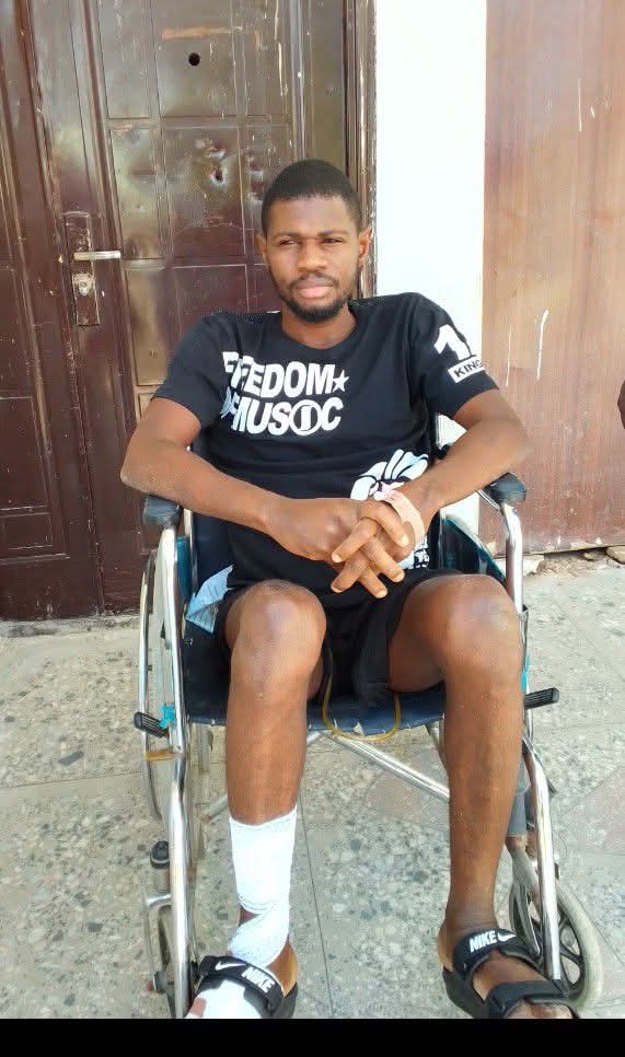 Nigerian man pens heartbreaking post addressing those who started avoiding him after his spinal cord injury