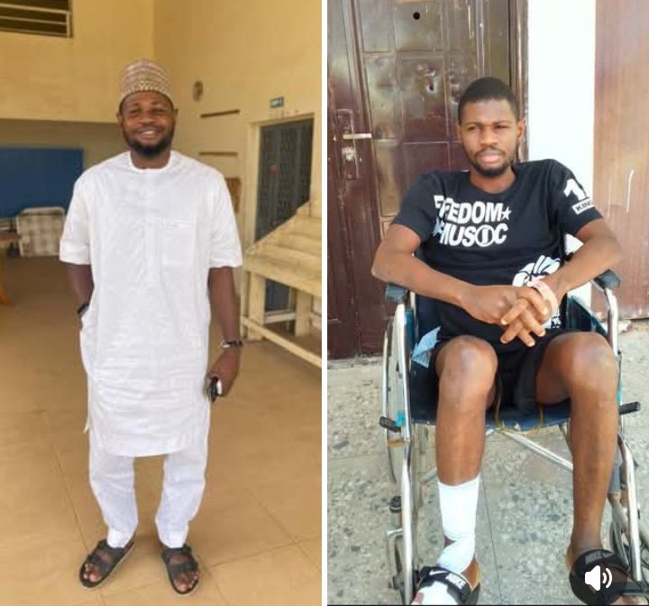 Nigerian man pens heartbreaking post addressing those who started avoiding him after his spinal cord injury