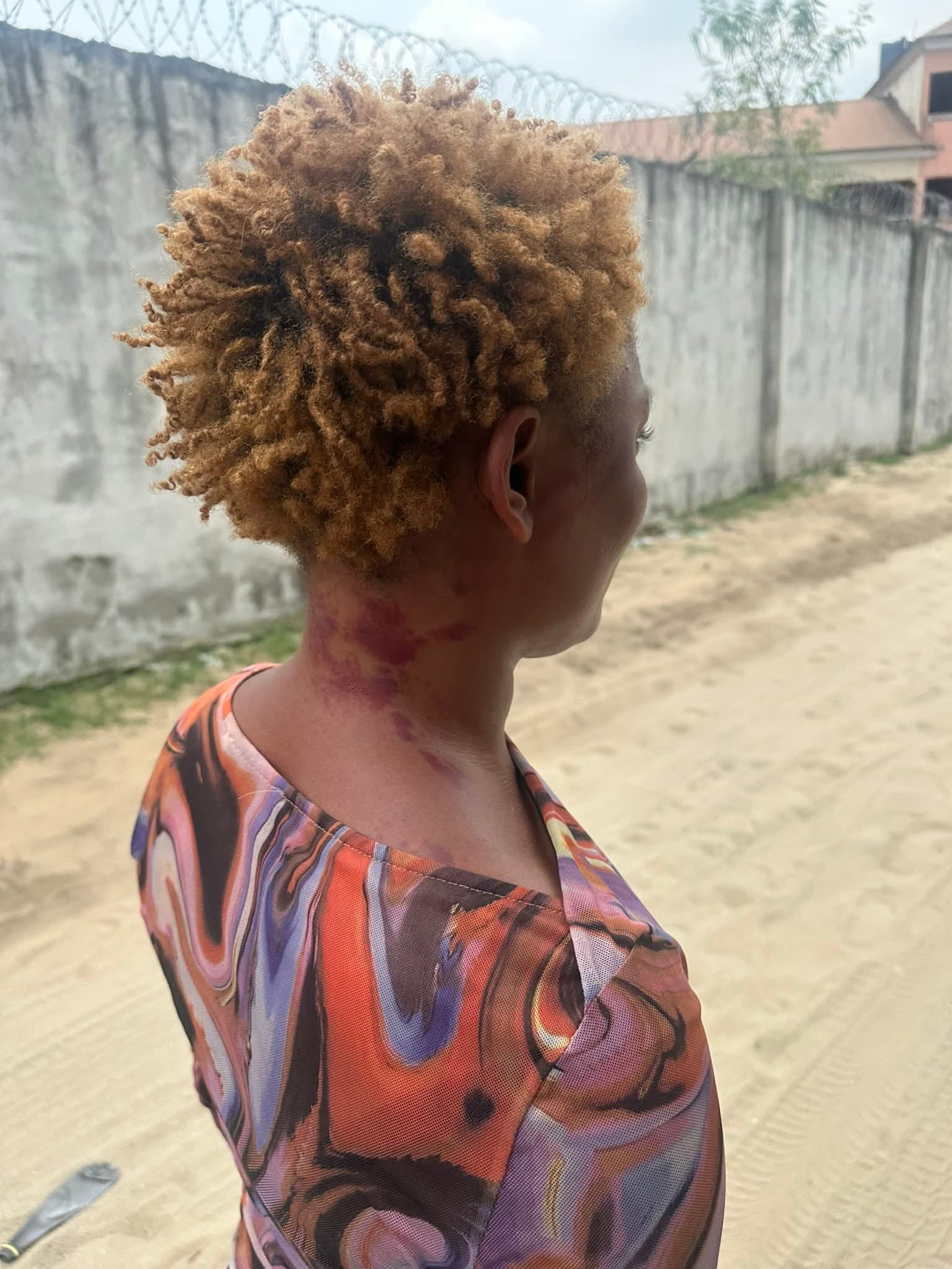 "I promise never to go near marriage ever again" Woman writes as she reveals inj^ries she sustained while married