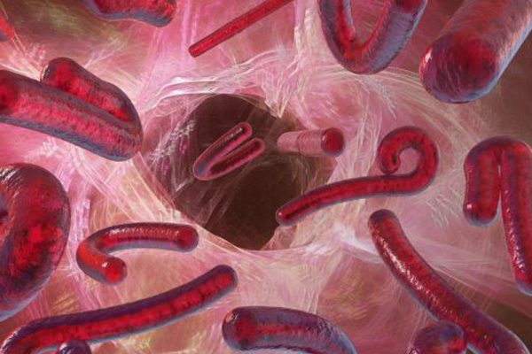 No vaccine, specific treatment for Ebola strain in Nigeria — WHO