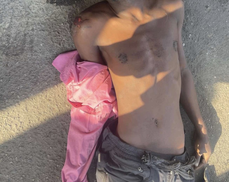 Man di�s after assault in Marina car park; suspect arrested (photos/video)