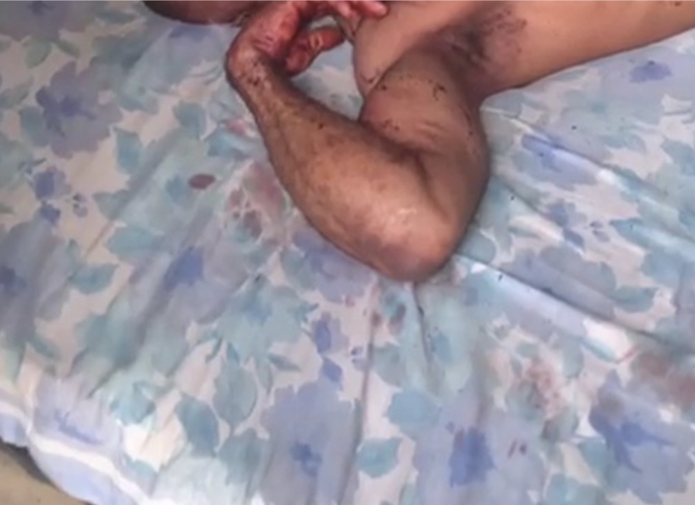 Grandma attacked and k!lled at her home in Iyana-Isashi while man who witnessed incident was brut@lised to within an inch of his life (photos/videos)