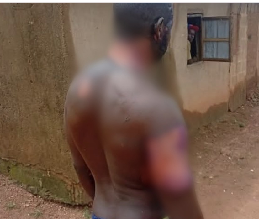 Kaduna man says he still loves his wife after she poured hot water on him