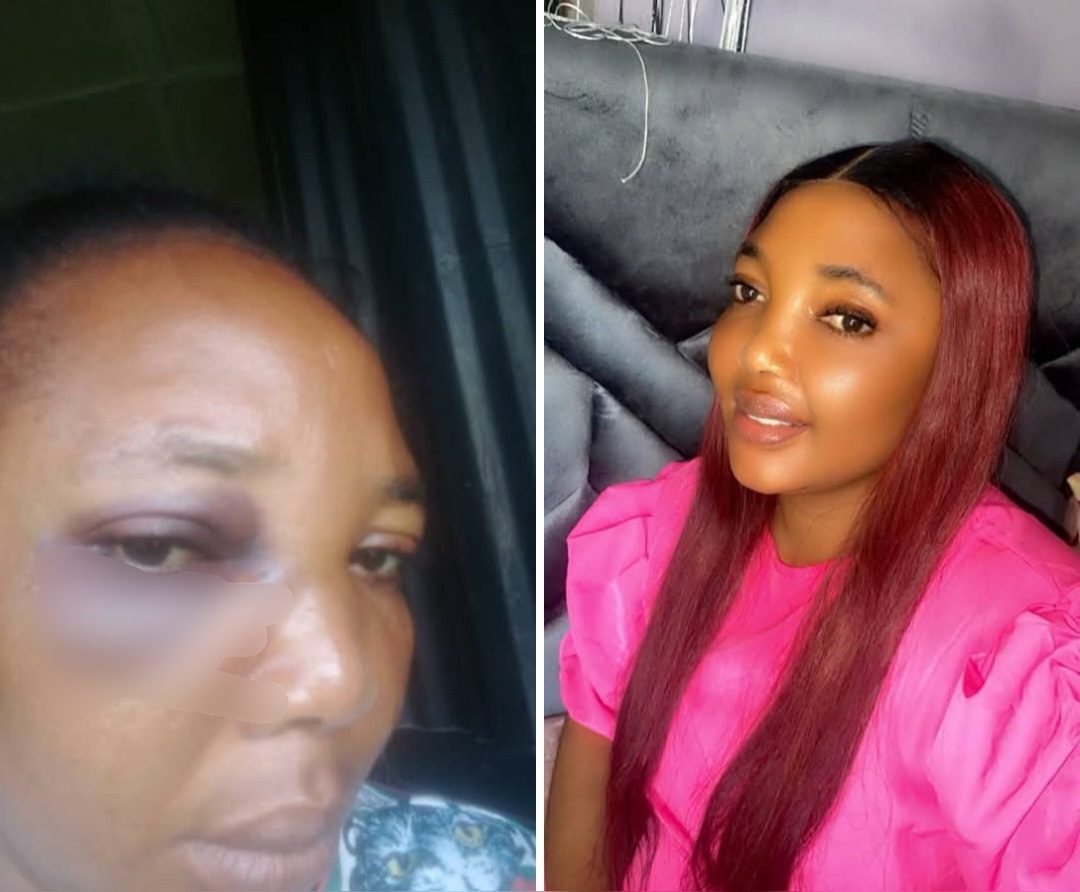 "I leave to live for my child" Woman writes as she shares what she allegedly went through in marriage