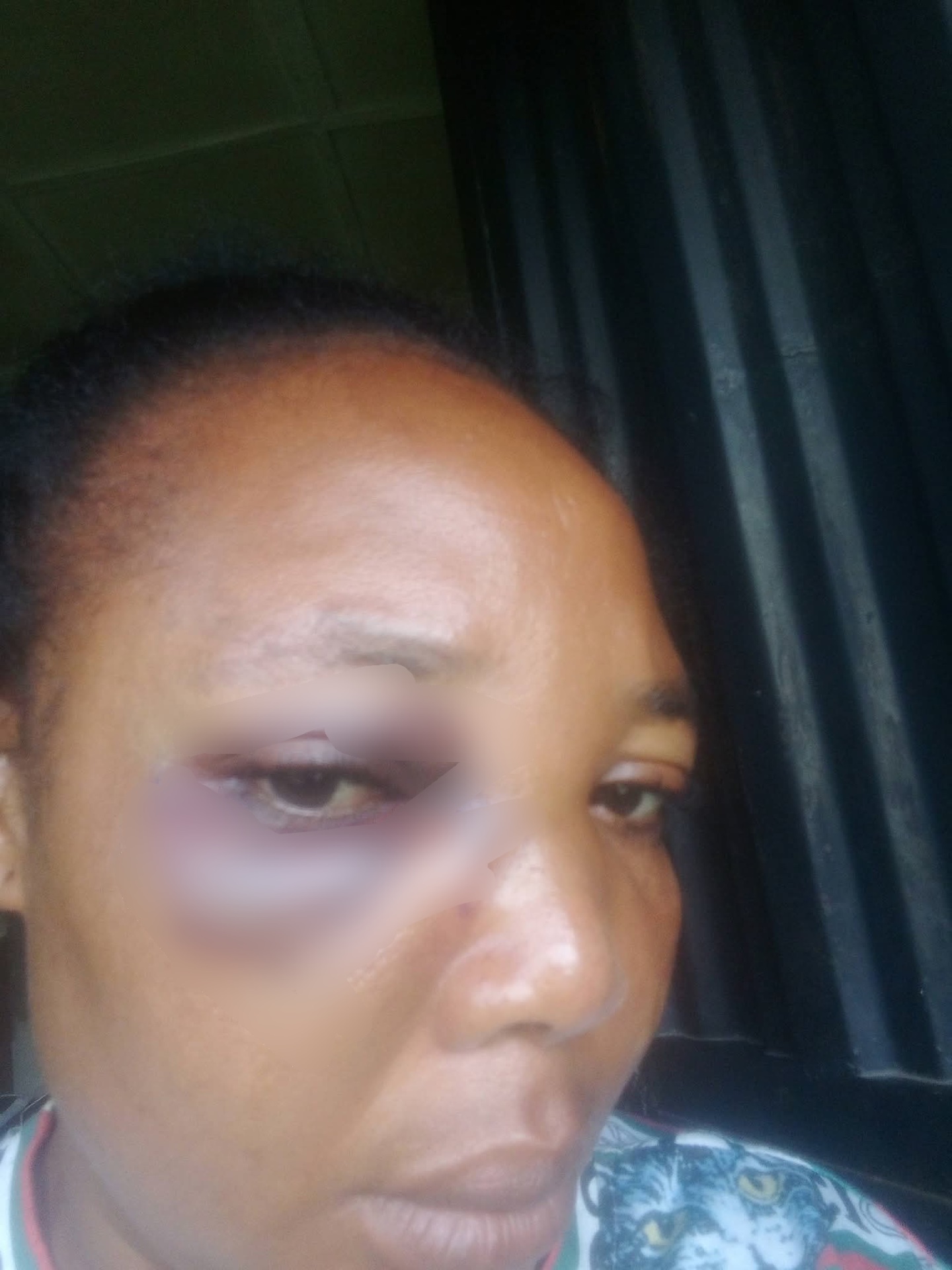 "I leave to live for my child" Woman writes as she shares what she allegedly went through in marriage