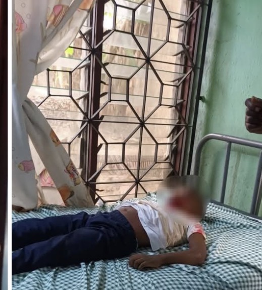 Boy, 4, survives after falling from two-storey building in Aba