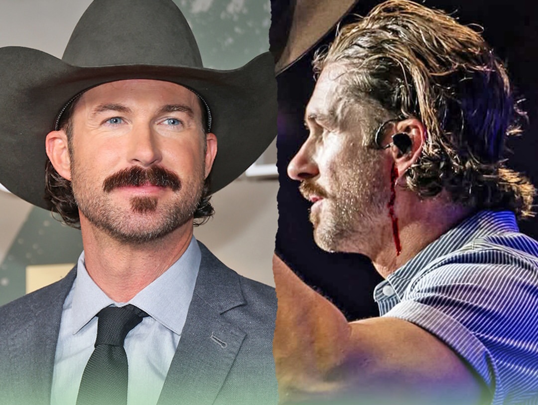 Singer Riley Green bleeds on stage after fan threw phone at his head during concert