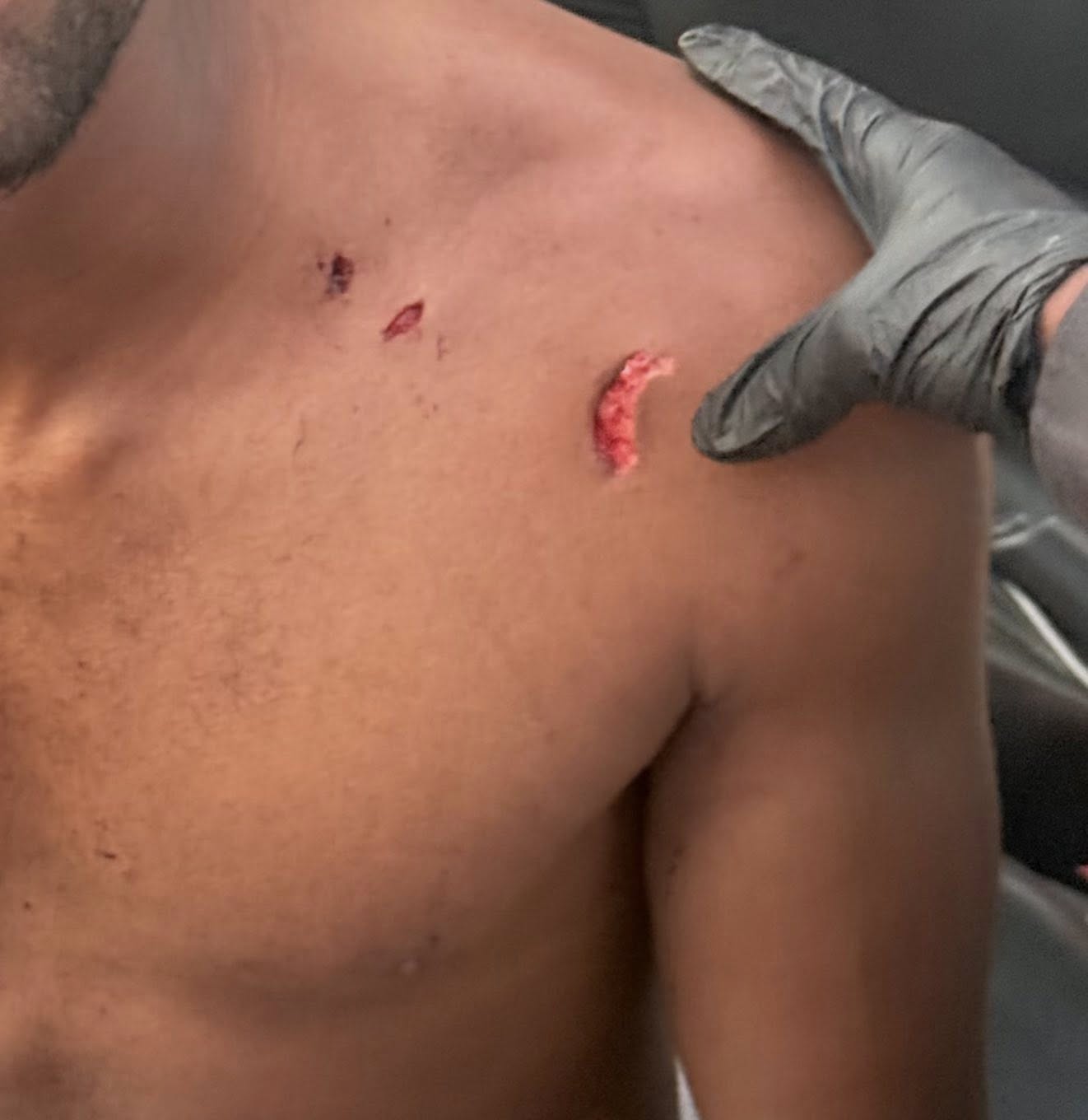 Man stabs friend multiple times, claims he insulted his mother during argument