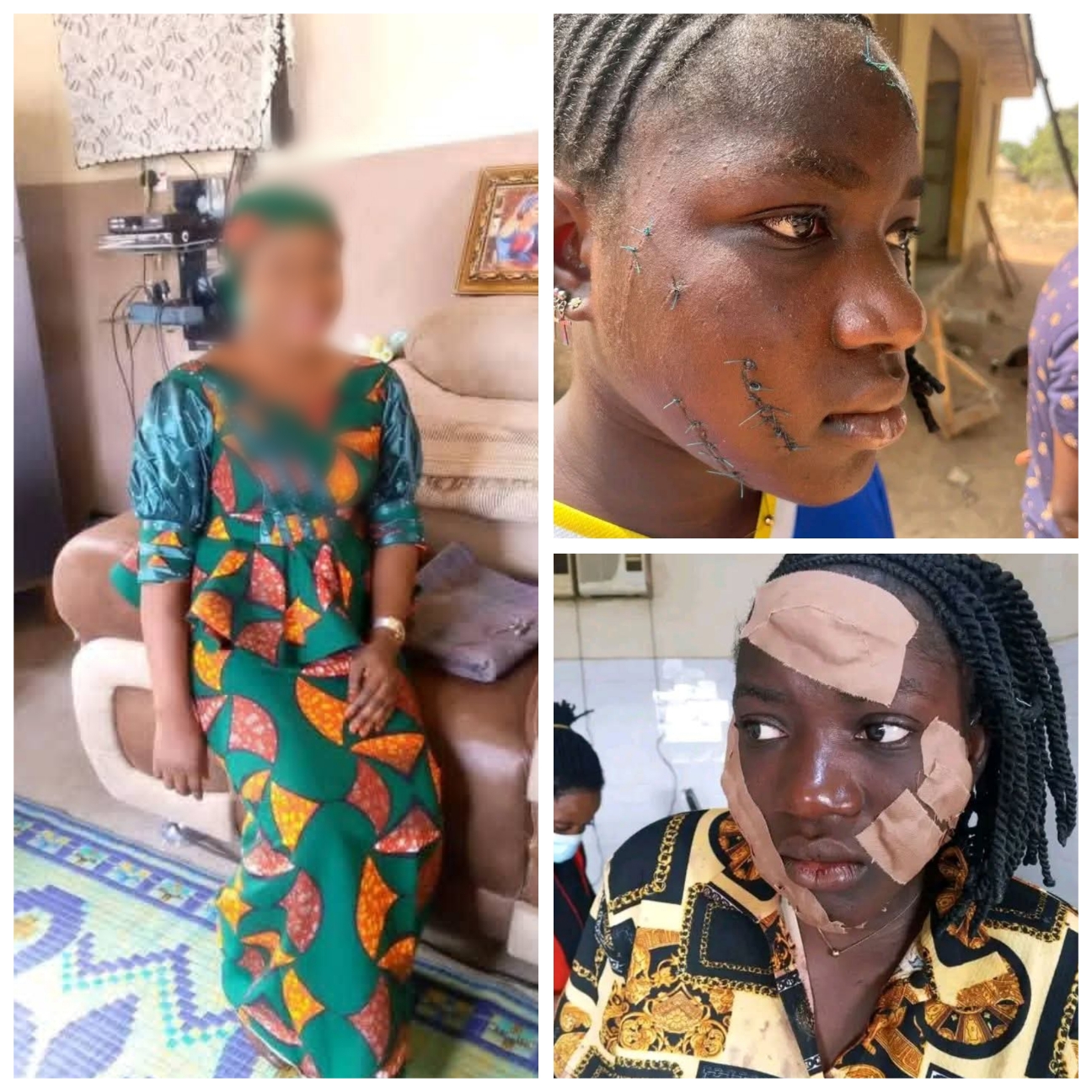 Taraba Governor orders arrest of associates of married woman who attacked teenage girl with razor for intimidating victim and her guardian
