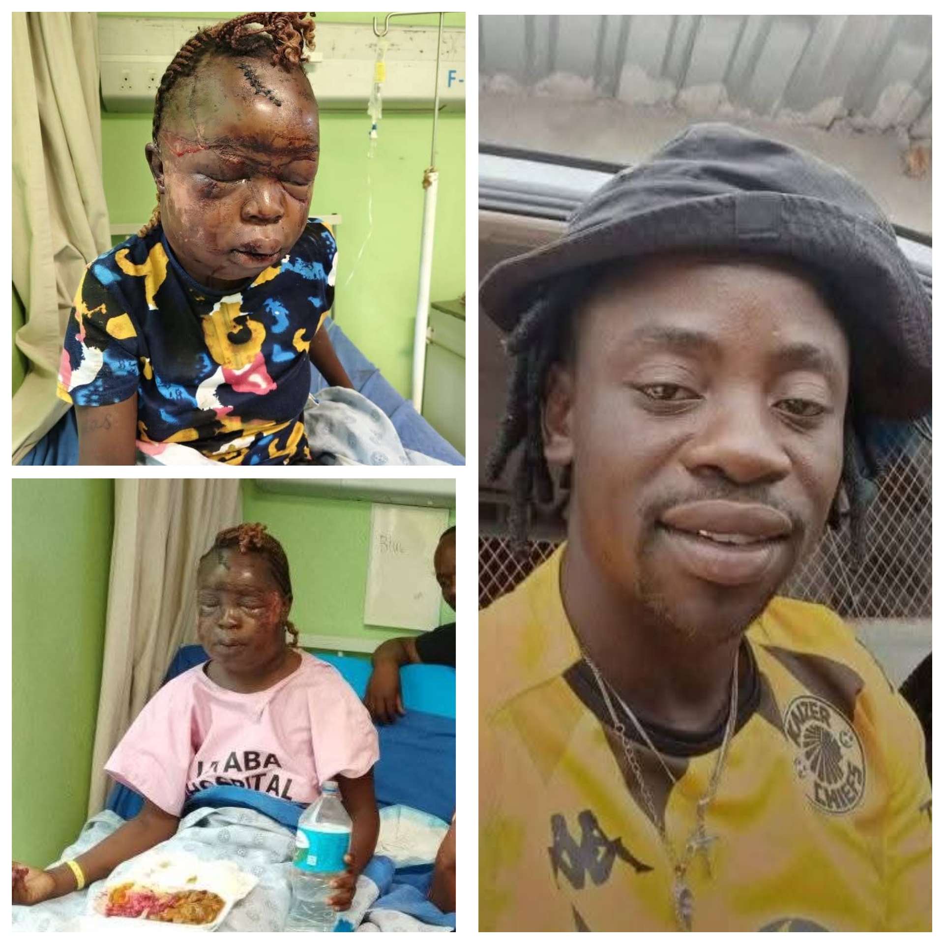 South African woman beaten to pulp by her ex-boyfriend