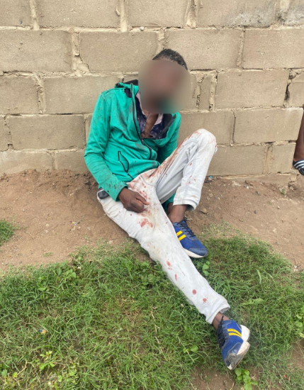 51-year-old man assaulted by his drunk girlfriend for refusing to give her money to buy more alcohol