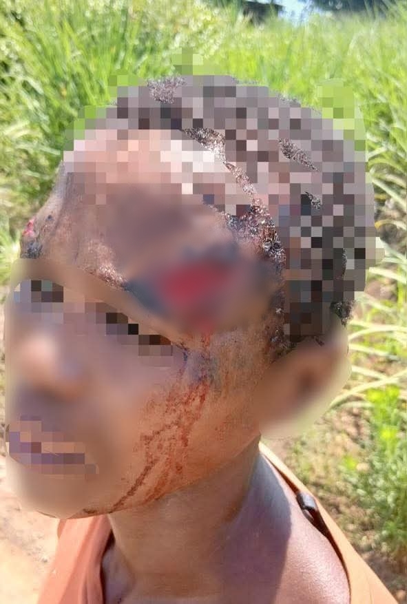 43-year-old woman brutally attacked and s3xually assaulted by her boyfriend after being accused of cheating