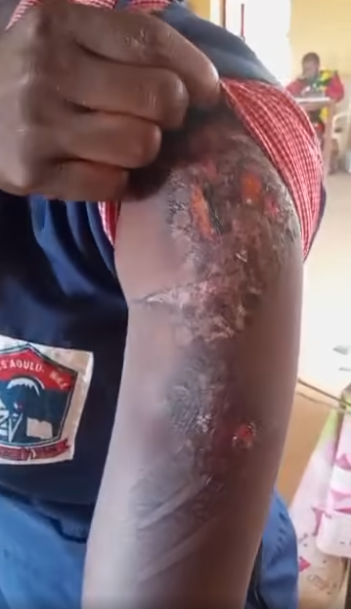 Woman tortures 17-year-old maid with hot iron in Anambra (video)
