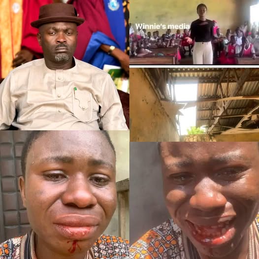 Lady demands justice after Rivers local govt chairman allegedly assaulted her for sharing a video showing the dilapidated structure of a school in the state (video)