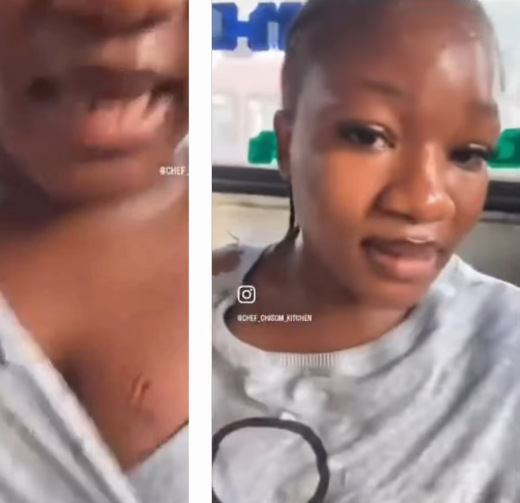 Lady shows the bite mark a man left on her breast after she got attacked inside a public bus