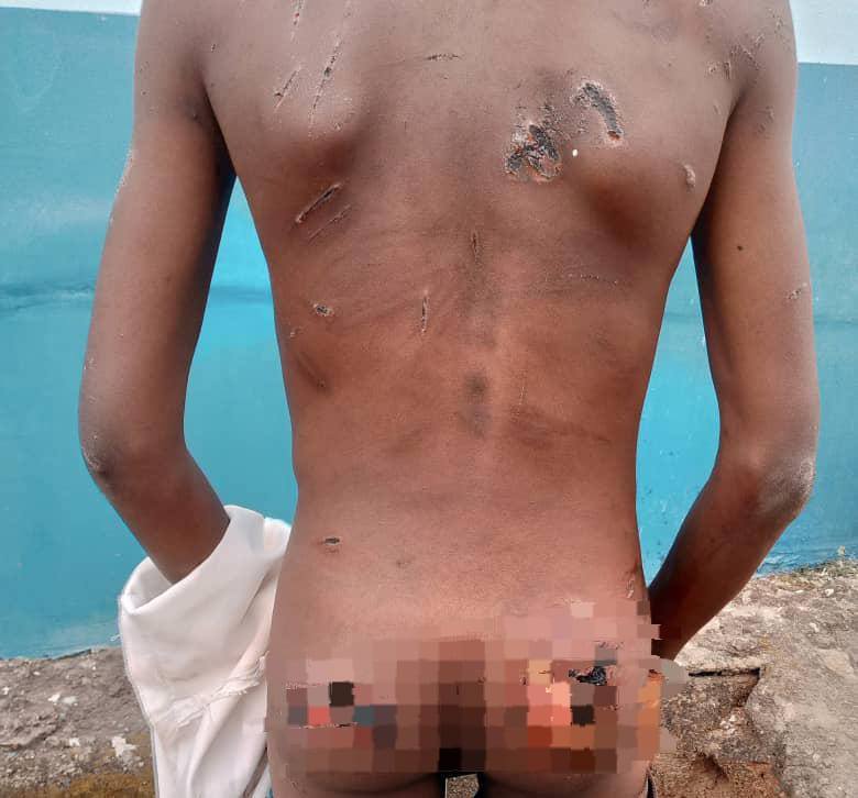 NSCDC arrests two Islamic clerics for torturing Quranic pupils with hot cutlass in Ondo