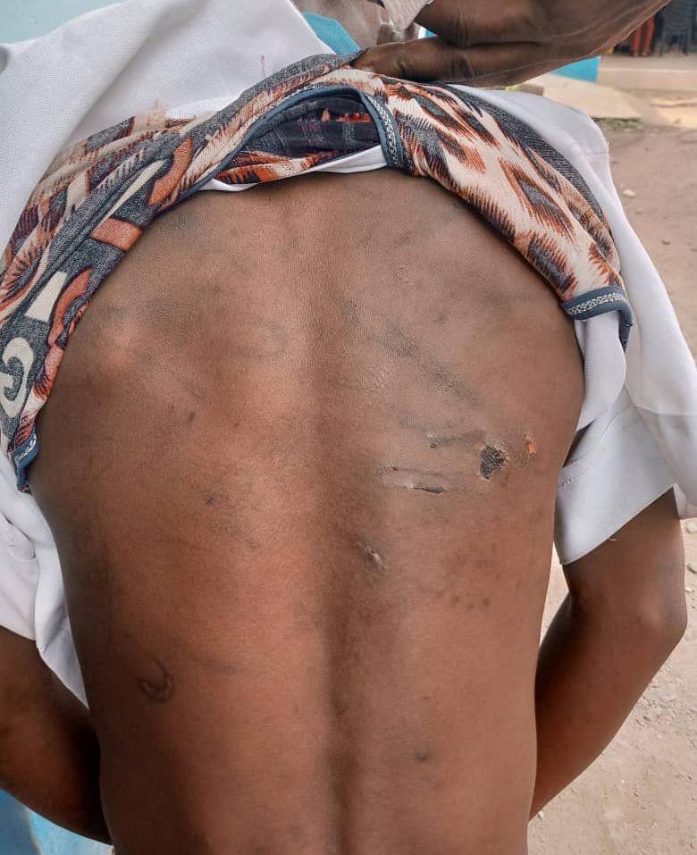 NSCDC arrests two Islamic clerics for torturing Quranic pupils with hot cutlass in Ondo