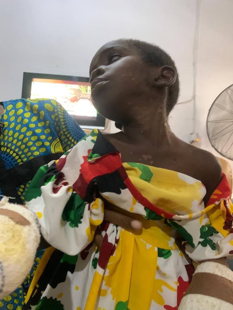 Court remands Imo woman for burning 5-year-old maid