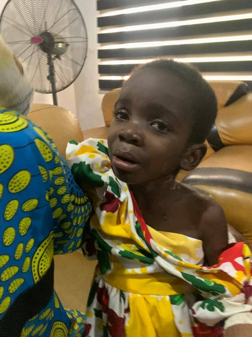 Court remands Imo woman for burning 5-year-old maid