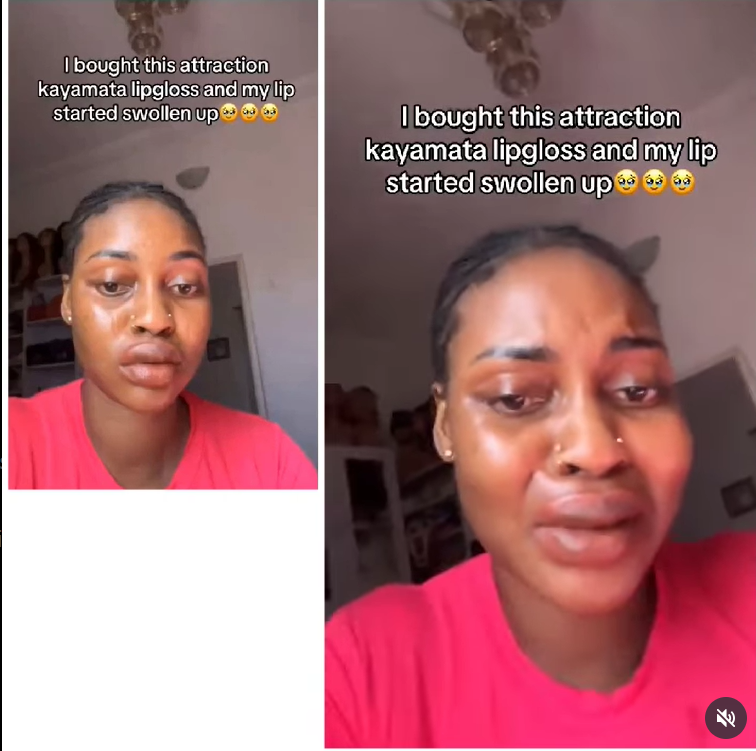 Nigerian lady cries out after her lips swell badly from using attraction Kayamata lip gloss
