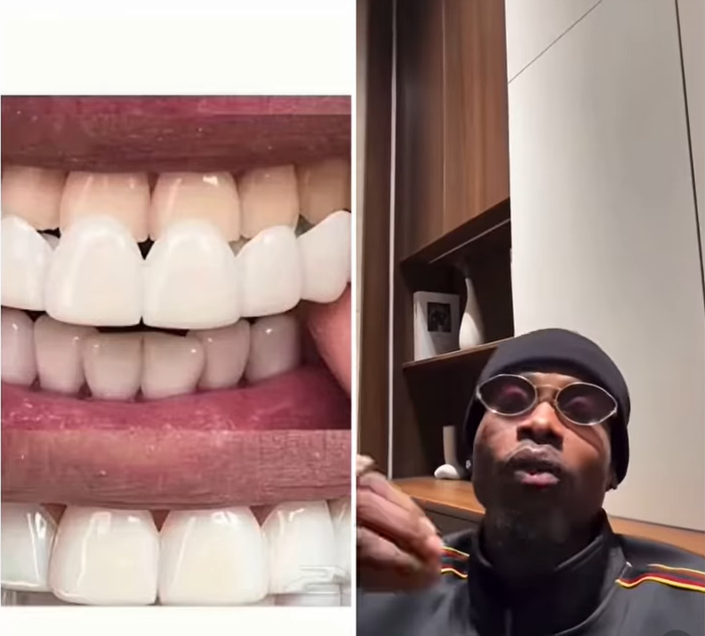âYou canât have sparkling white teeth and still have bad breathâ â Nightlife Influencer Yhemolee speaks on veneers and hygiene