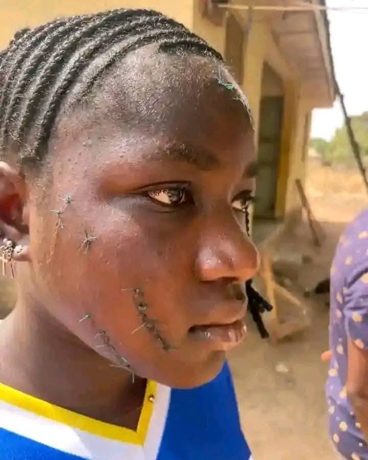 Taraba Governor orders arrest of associates of married woman who attacked teenage girl with razor for intimidating victim and her guardian