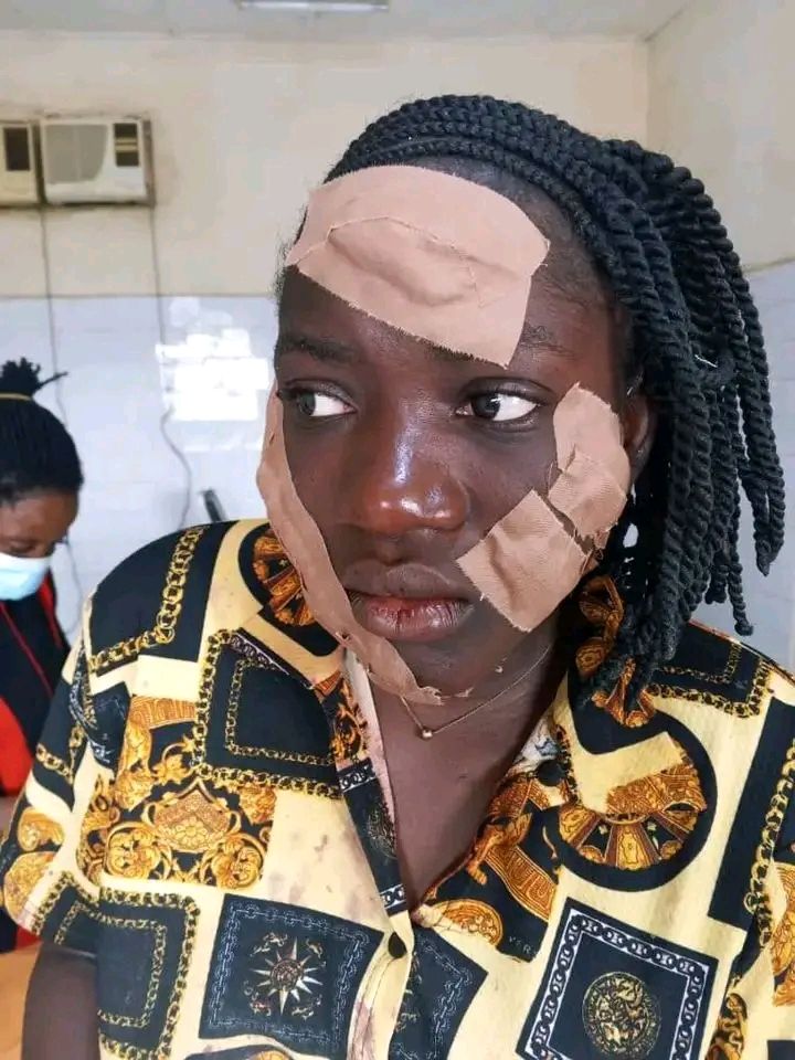 Taraba Governor orders arrest of associates of married woman who attacked teenage girl with razor for intimidating victim and her guardian