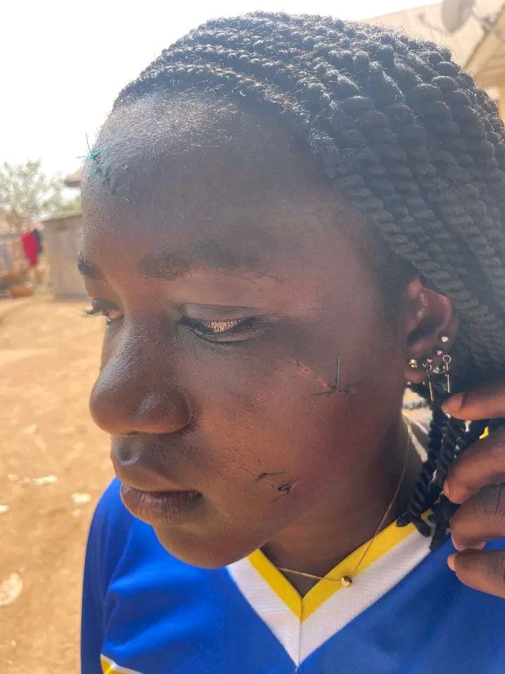 Taraba Governor orders arrest of associates of married woman who attacked teenage girl with razor for intimidating victim and her guardian
