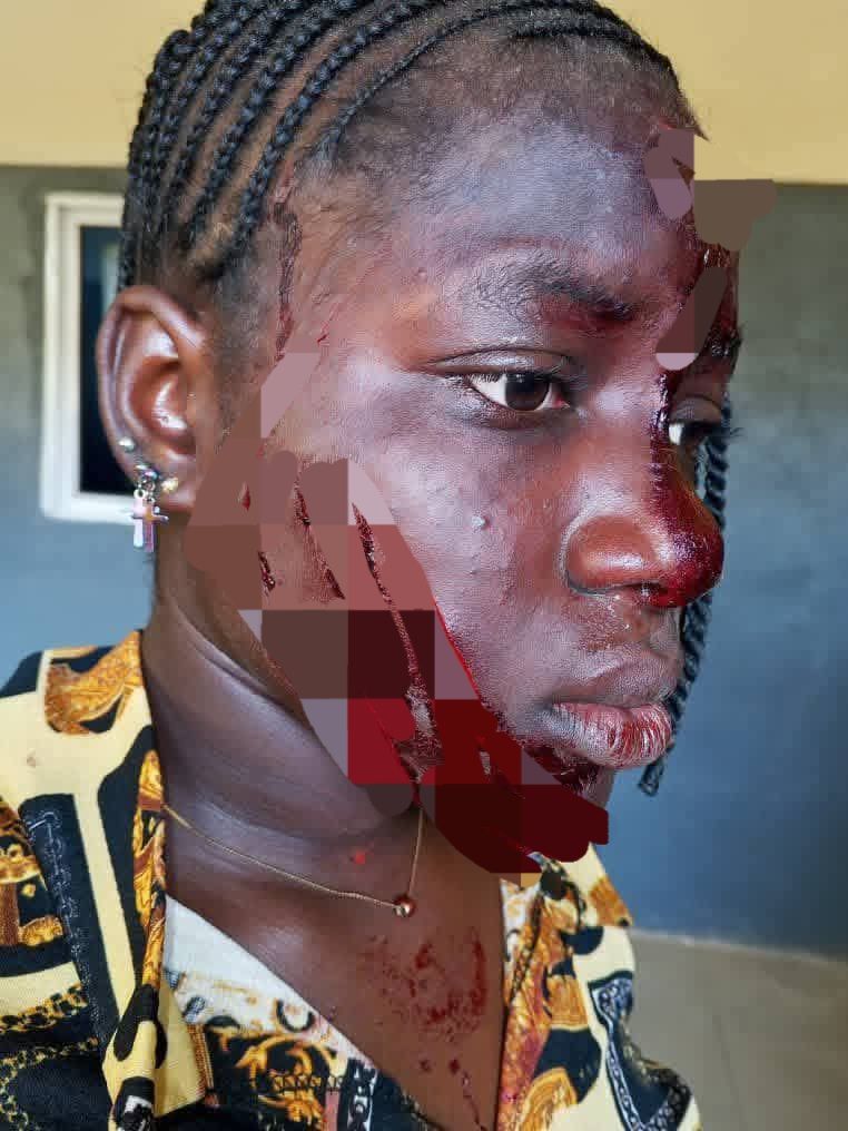 Taraba Governor orders arrest of associates of married woman who attacked teenage girl with razor for intimidating victim and her guardian