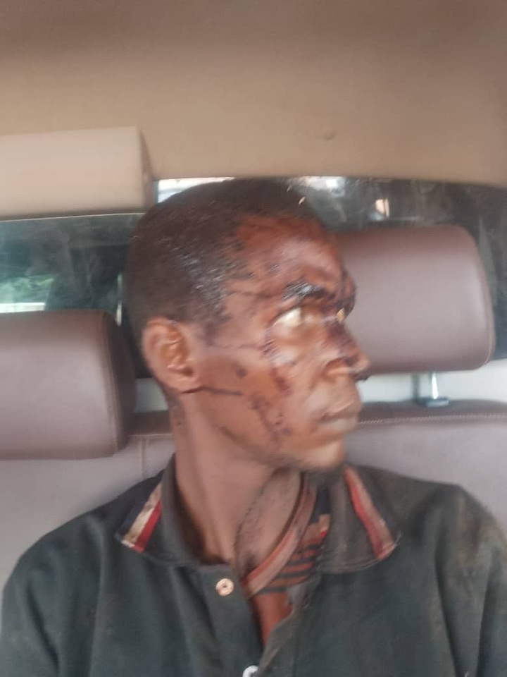 Troops rescue kidnapped victim, arrest suspect who sustained injuries from mob action in Taraba