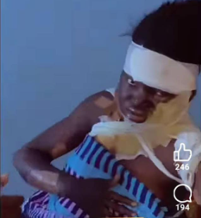 Woman pours hot water on her boyfriend?s co-worker in Kano