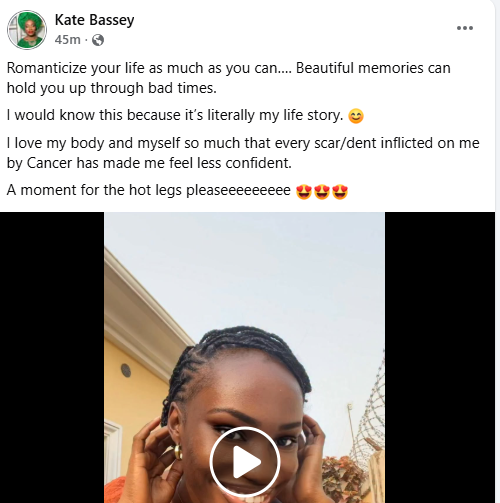 Romanticize your life as much as you can - Nigerian woman who lost three ribs to cancer advises people as she shares throwback video of herself