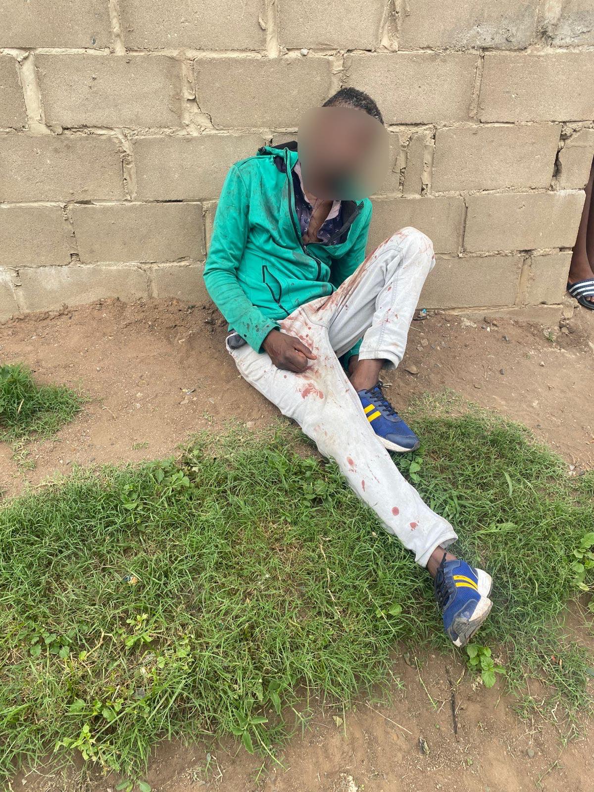 51-year-old man assaulted by his drunk girlfriend for refusing to give her money to buy more alcohol