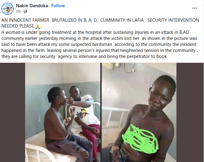 Suspected herdsmen chop off woman