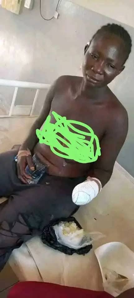 Suspected herdsmen chop off woman