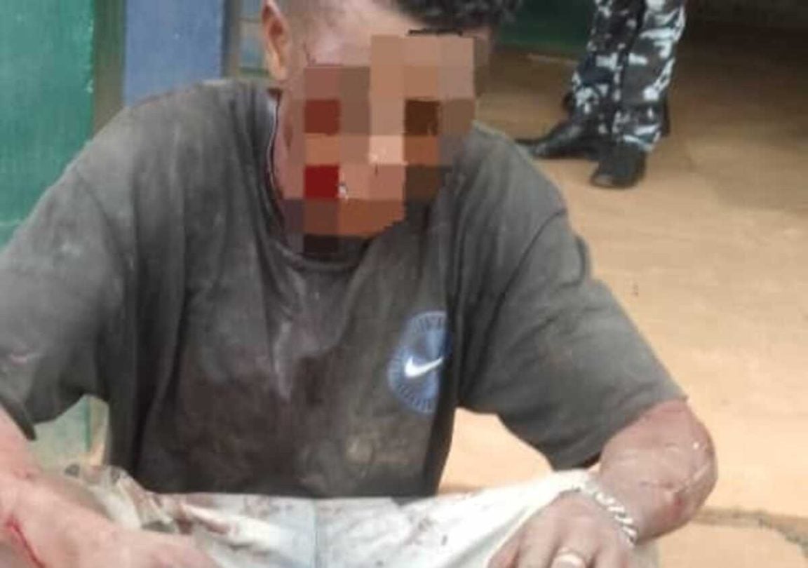 Man found with human leg escapes mob attack in Oyo