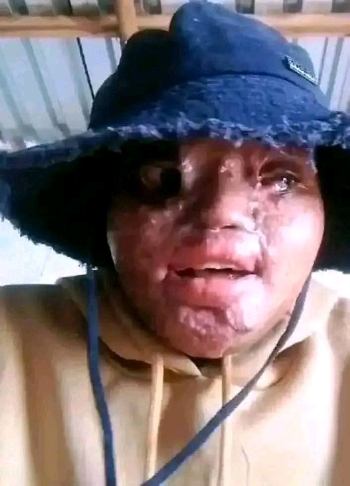 Woman sentenced to 18 years imprisonment for attacking ex-boyfriend