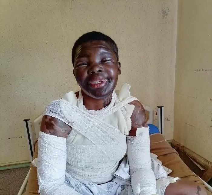 Woman sentenced to 18 years imprisonment for attacking ex-boyfriend