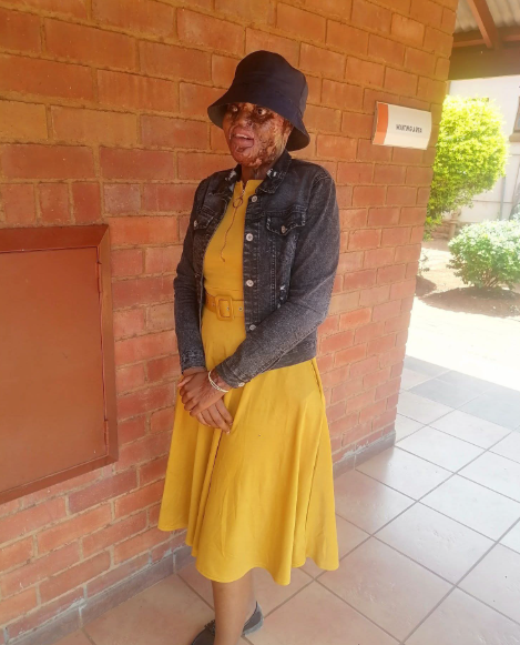 Woman sentenced to 18 years imprisonment for attacking ex-boyfriend