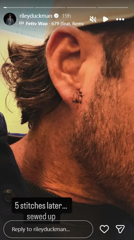 Singer Riley Green bleeds on stage after fan threw phone at his head during concert