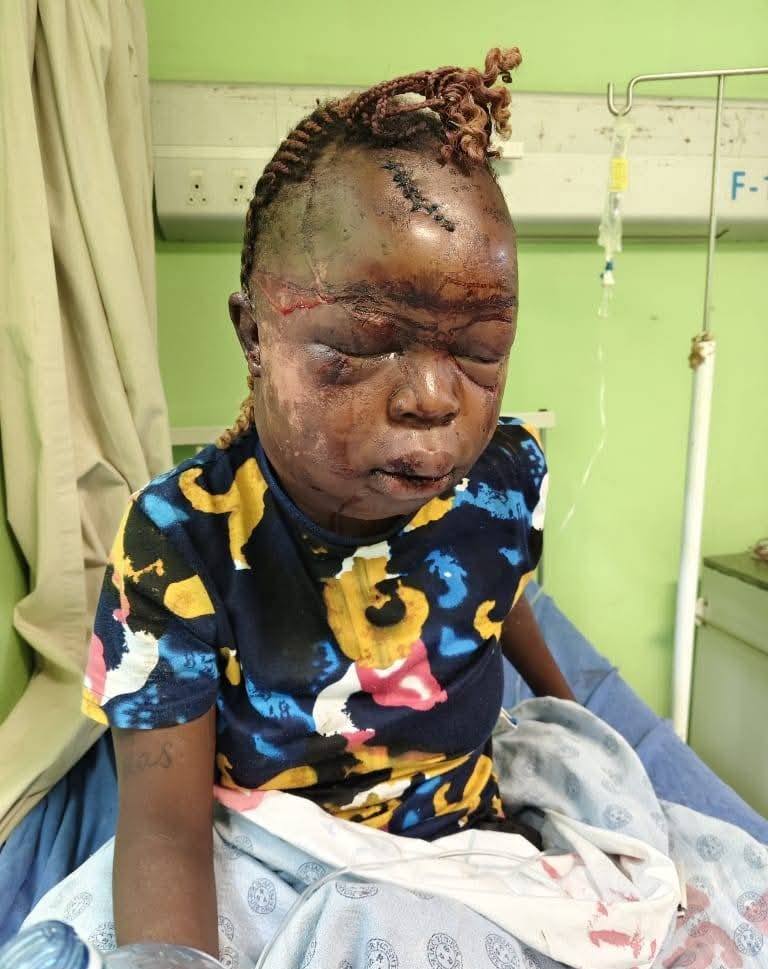 South African woman beaten to pulp by her ex-boyfriend