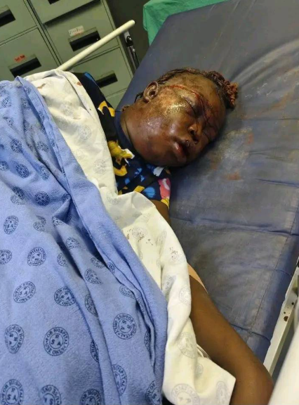 South African woman beaten to pulp by her ex-boyfriend