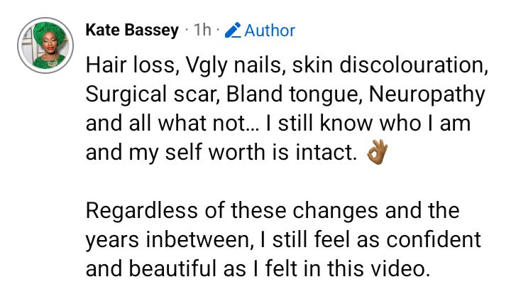 Romanticize your life as much as you can - Nigerian woman who lost three ribs to cancer advises people as she shares throwback video of herself